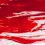 Star still bleeding as rescue looms as ‘still incomplete’